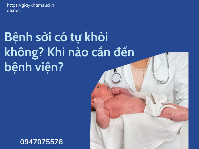 Bệnh sởi: Những thông tin quan trọng mà bạn cần phải biết!