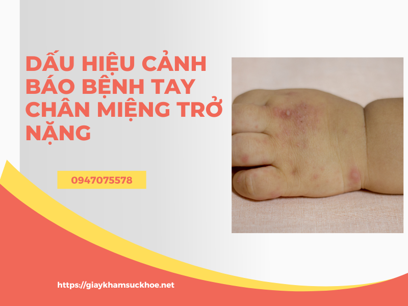 Cách phòng và điều trị bệnh tay chân miệng tại nhà hiệu quả