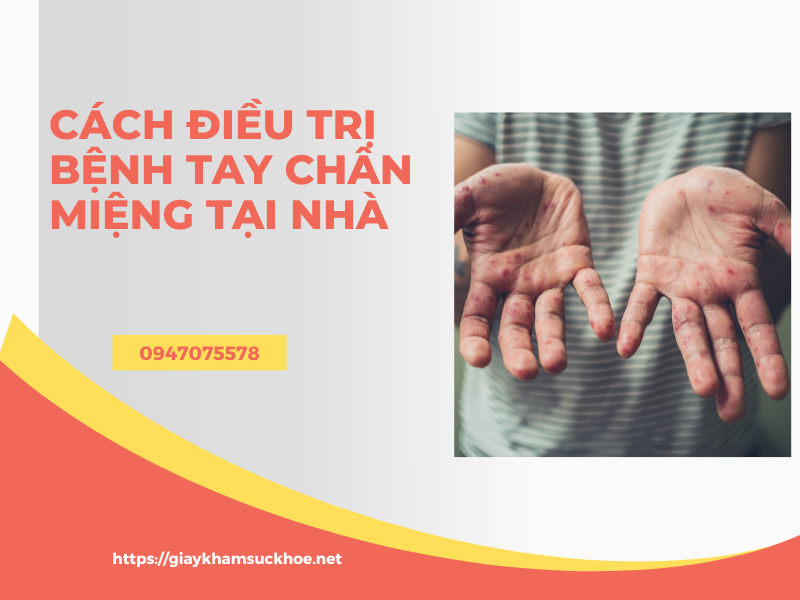 Cách phòng và điều trị bệnh tay chân miệng tại nhà hiệu quả