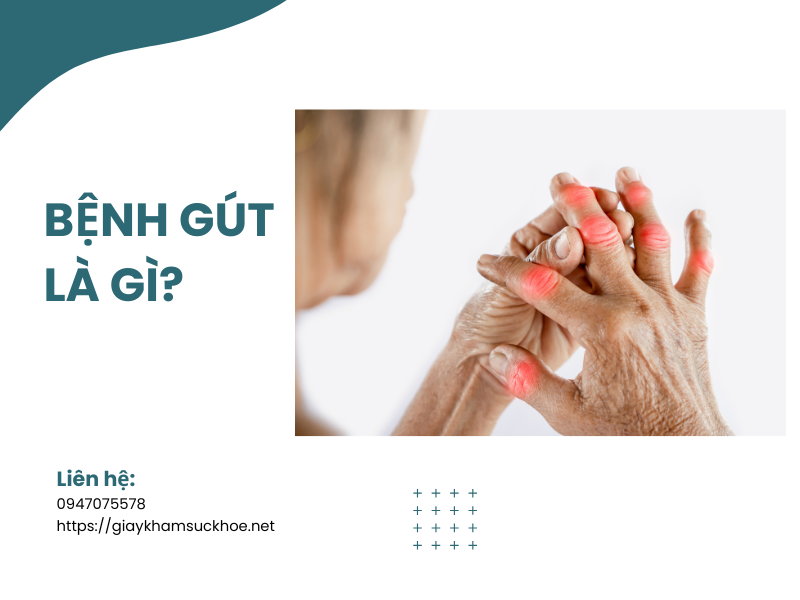 giai-dap-cac-thac-mac-thuong-gap-ve-benh-gut